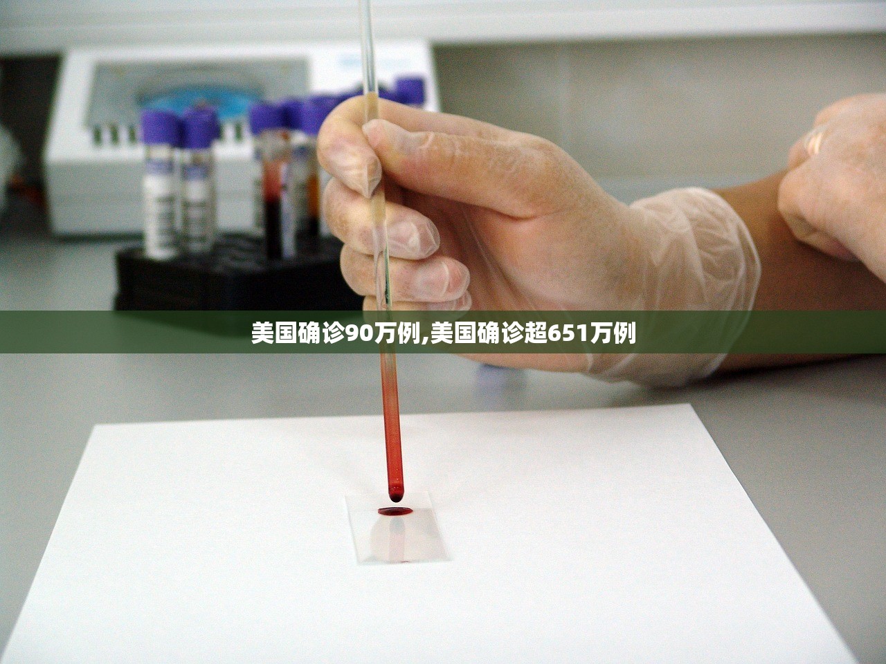 美国确诊90万例,美国确诊超651万例