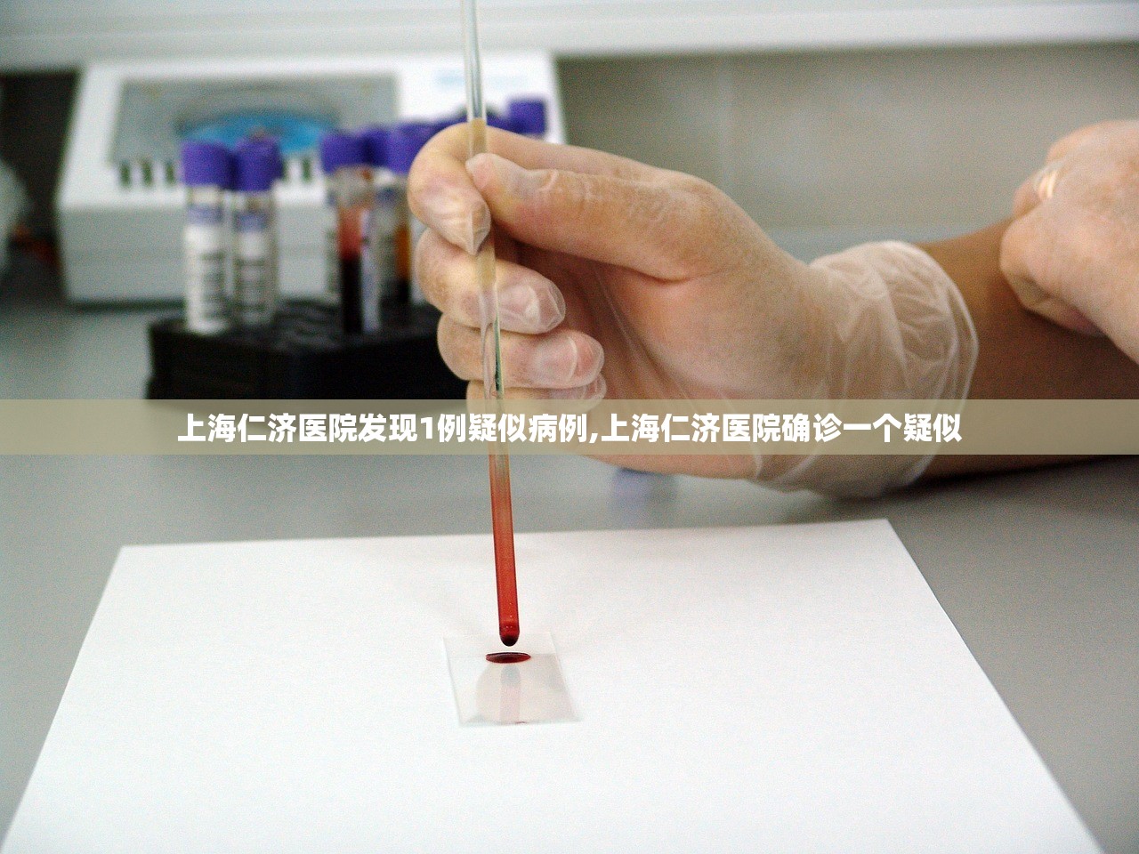 上海仁济医院发现1例疑似病例,上海仁济医院确诊一个疑似