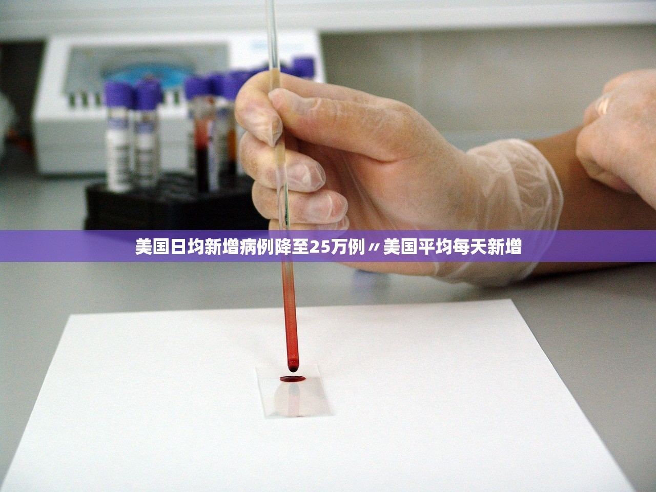 美国日均新增病例降至25万例〃美国平均每天新增 美国日均新增病例降至25万例〃美国平均每天新增